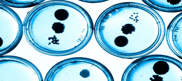 Code or Conduct? Unraveling the Genetic vs. Lifestyle Battle in Alzheimer’s